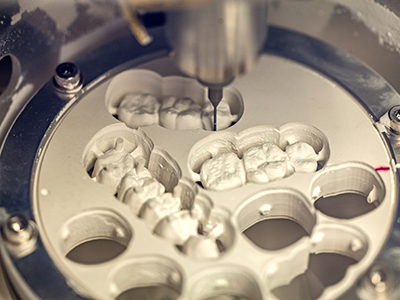 Union Dental Group | CBCT, Extractions and Implant Restorations